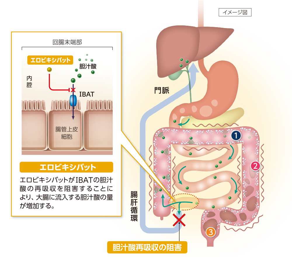 エロビキシバット（エロビキシバットがⅠBATの胆汁 酸の再吸収を阻害することに より、大腸に流入する胆汁酸の量 が増加する。）、胆汁酸再吸収の阻害、イメージ図