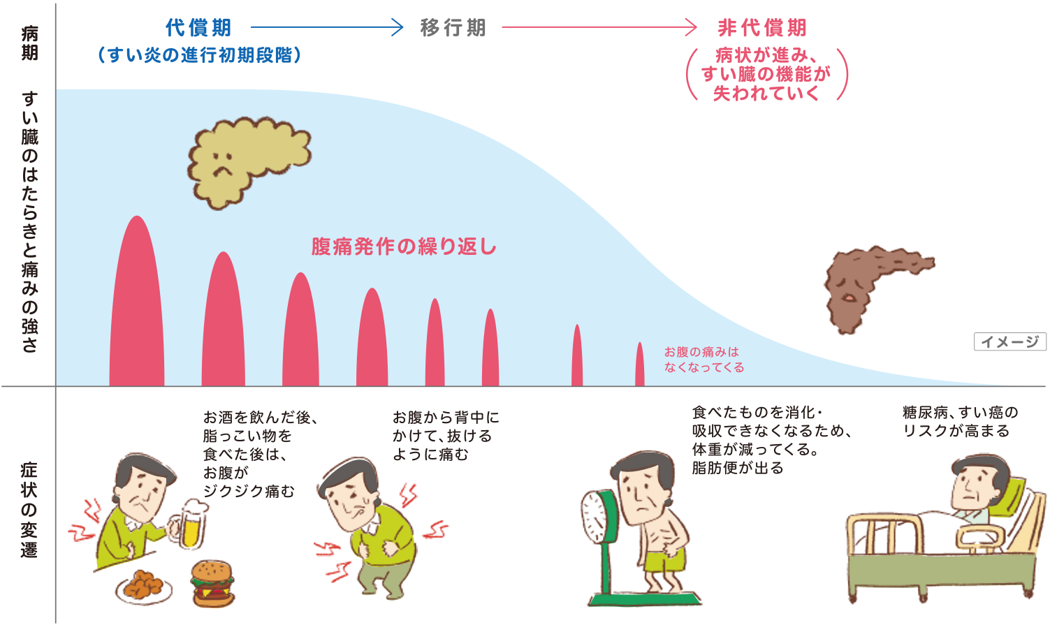 グラフ：病期／すい臓のはたらきと痛みの強さ／症状の変遷