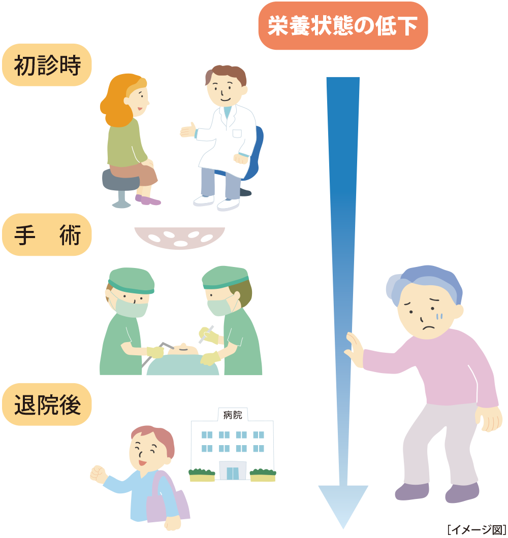 栄養状態の低下（イメージ図）